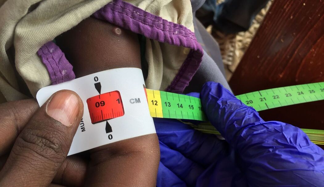 Tausende Kinder in Nord-Darfur von Hungertod bedroht