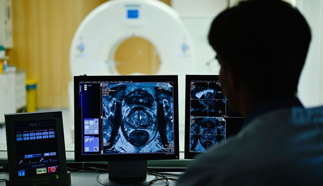 Mitarbeiter des DKFZ betrachtet Querschnittsbild einer Prostata