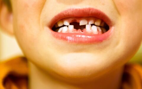 KINA - Die Milch und die Milchzähne