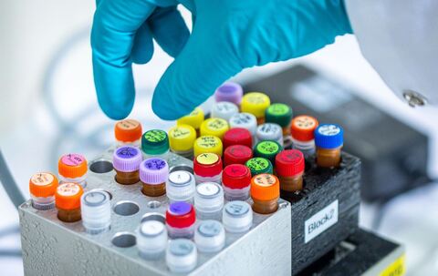 Zwei Menschen an Ehec gestorben