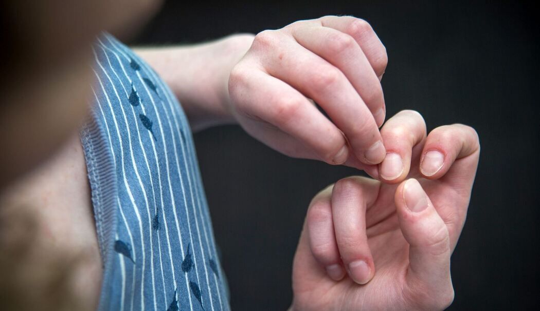 Eine Frau knibbelt an ihren Fingernägeln