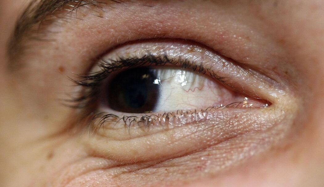 Warum Menschen beim Musikhören im Takt blinzeln