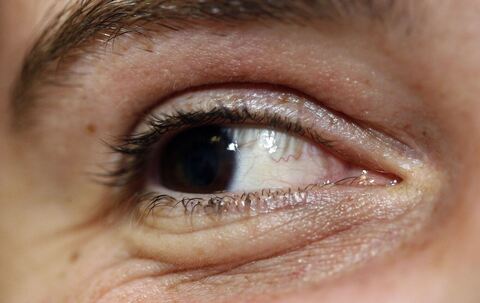 Warum Menschen beim Musikhören im Takt blinzeln