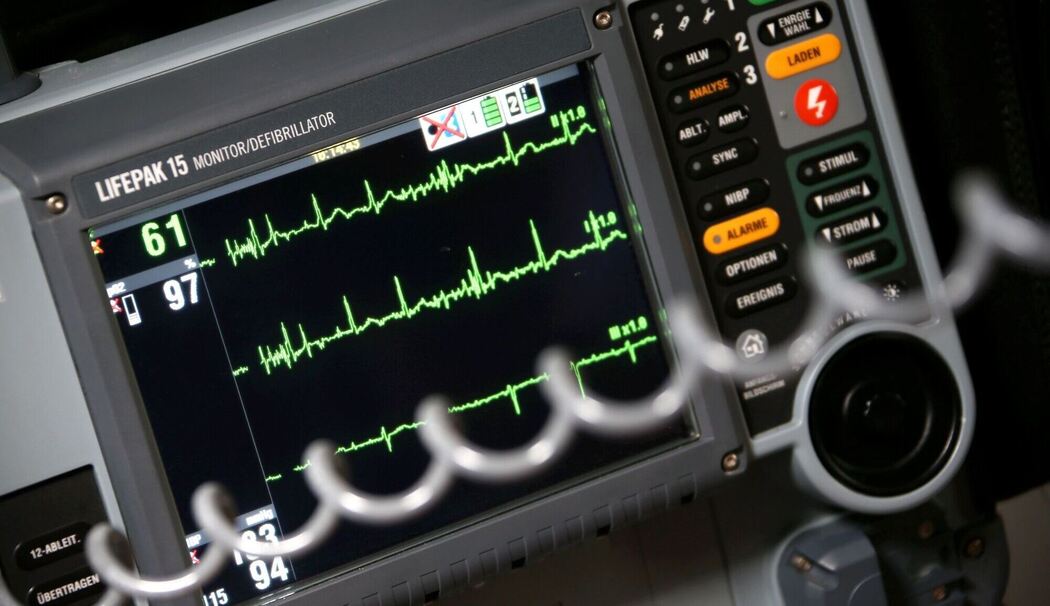 Sinusrhytmus eines Herzens ist auf einem EKG zu sehen
