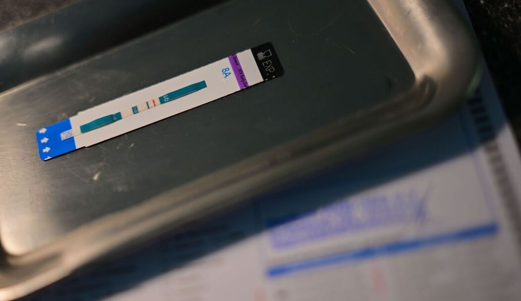 HIV-Test HIV-Test