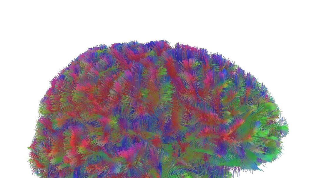 Kindheit bis Alter – Gehirnstruktur durchläuft fünf Phasen